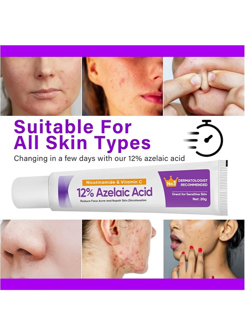CARVENCHY 3 Pcs Azelaic Acid Serum, Azelaic Acid 12% Cream,Hyaluronic Acid and Niacinamide, Relieves Redness, Dark Spots, Rosacea, Balances Excess Sebum, Brightening Face Skin Care Treatment for All Skin Types 20g*3 - Image 2